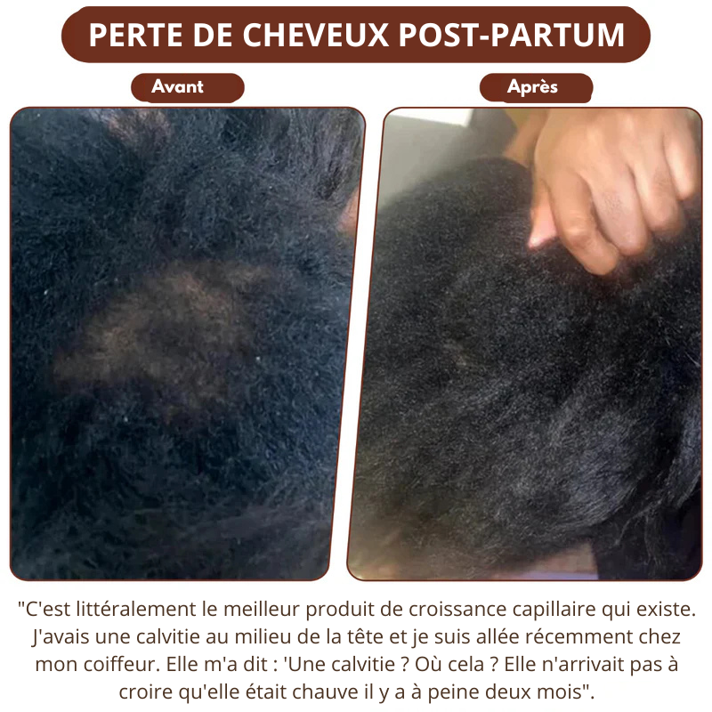 BATANA | Huile naturelle pour la croissance des cheveux