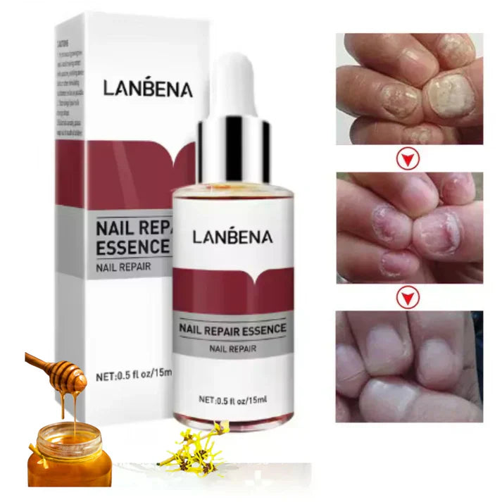 Huile réparatrice pour ongles aux plantes