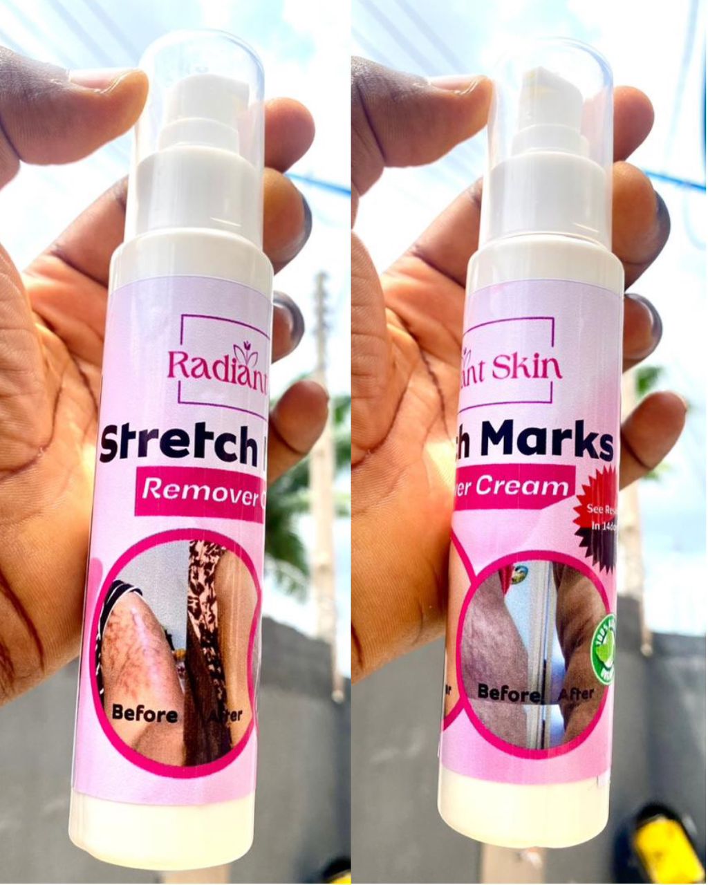 Crème anti-Vergeture Radiant⭐