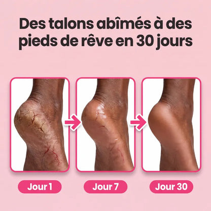 Pétilis™| Pieds Doux en une Utilisation