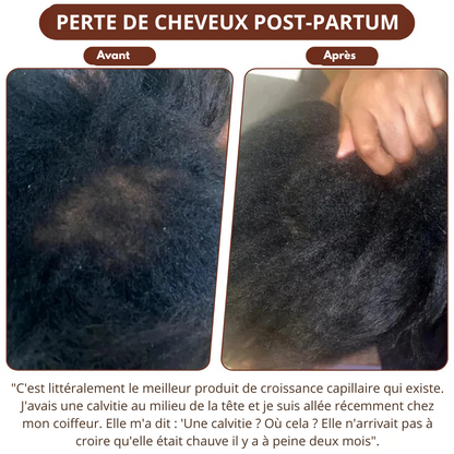 BATANA | Huile naturelle pour la croissance des cheveux