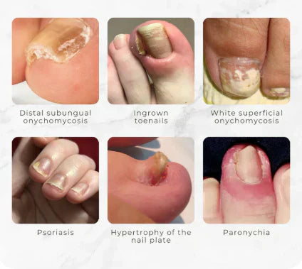 MagiPatch™ | 32 Patchs réparatrice pour ongles