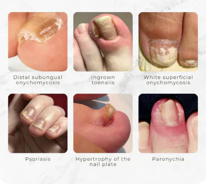 𝗟𝗔𝗡𝗕𝗘𝗡𝗔 | Huile réparatrice pour ongles - ML